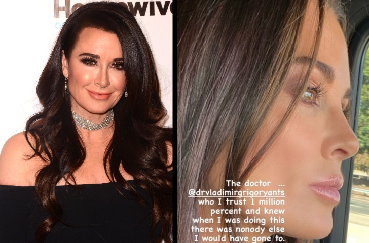 Kyle Richards in 2017 side by side with her in October 2020