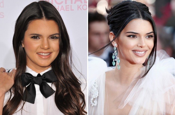 Side by side image of Kendall Jenner in 2010 and Kendall Jenner in 2018