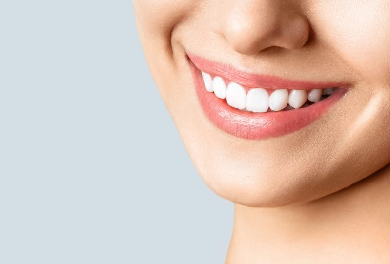 Woman smiling, showing healthy teeth.