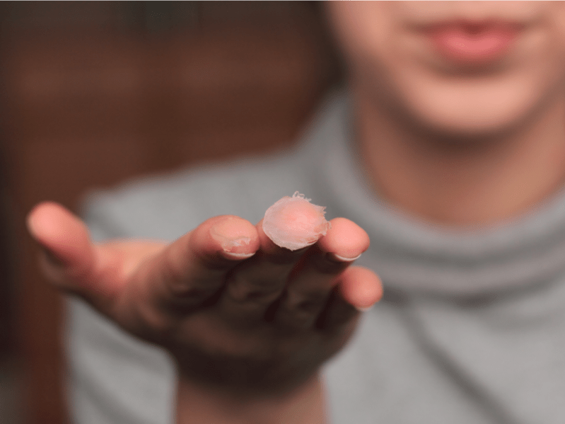 Woman holding out her hand with vaseline on her fingers