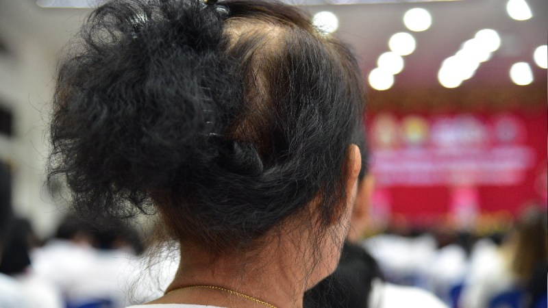 A woman with dark, thinning hair sits with her back to the camera
