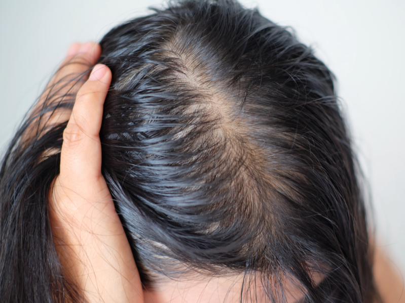 woman with thinning hair worry about his or her less thin hair on white background.