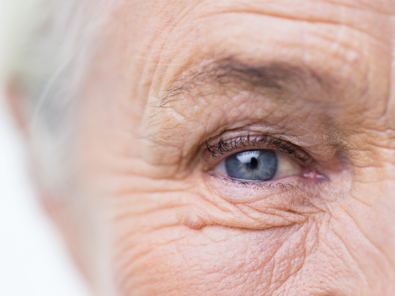 A closeup of an older woman's eye