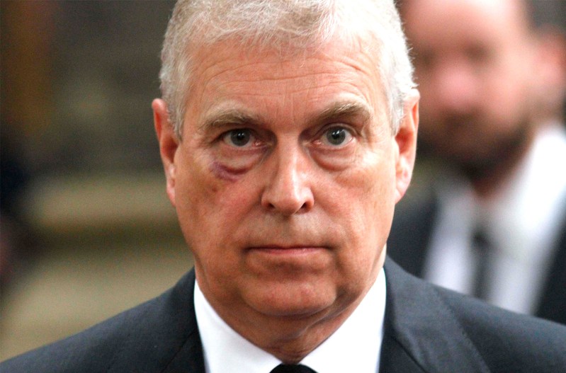 Close up of Prince Andrew with a bruise under one eye