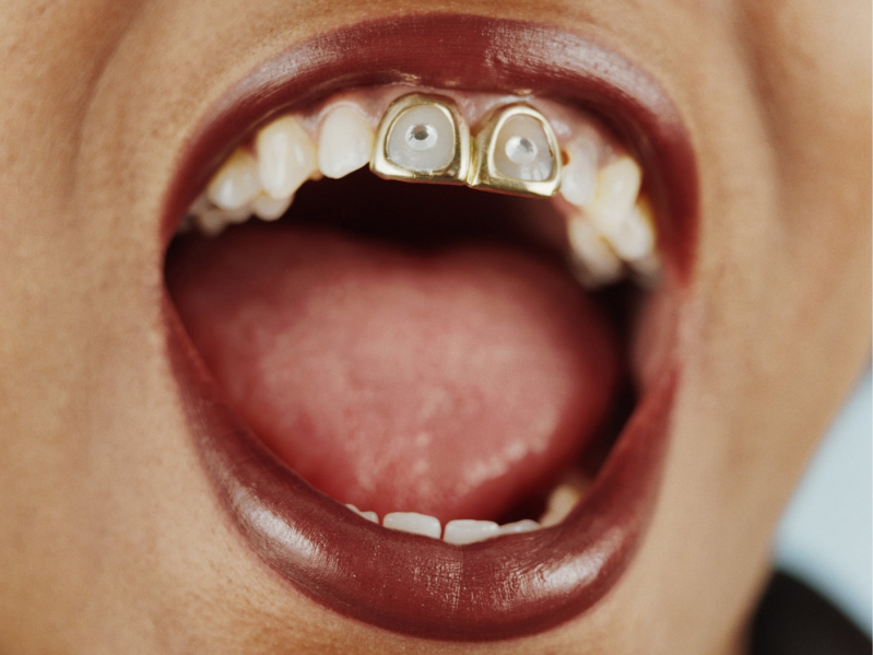 A close up of a woman with gems on her front teeth