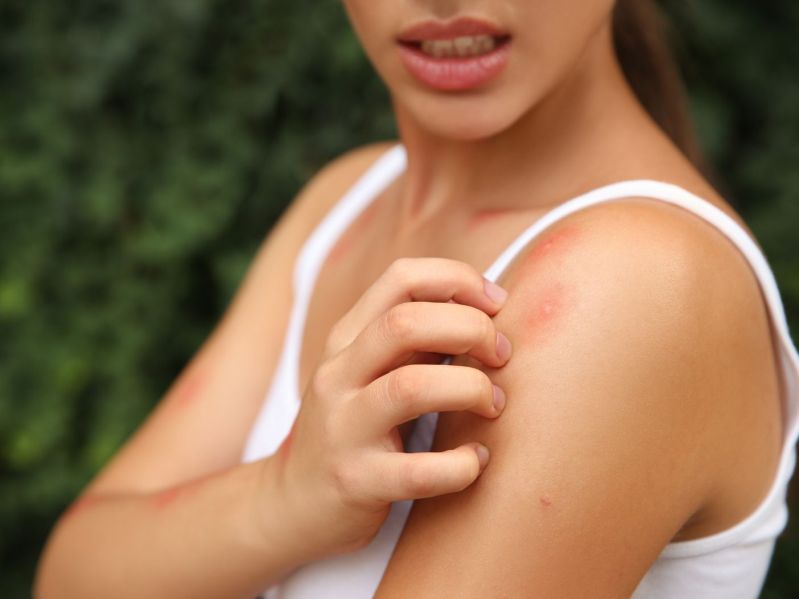 Woman in white tank top itching mosquito bits on her shoulder