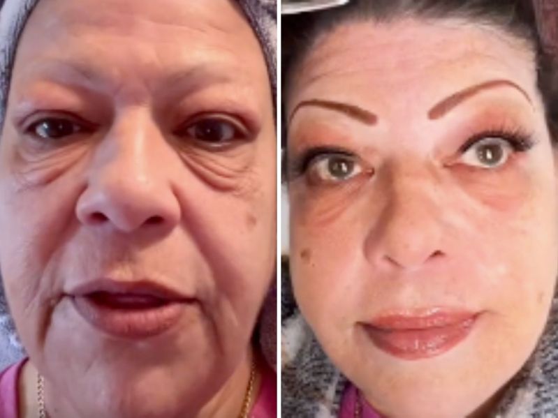 TikTok user before and after using Instant FIRMx Temporary Face Tightener