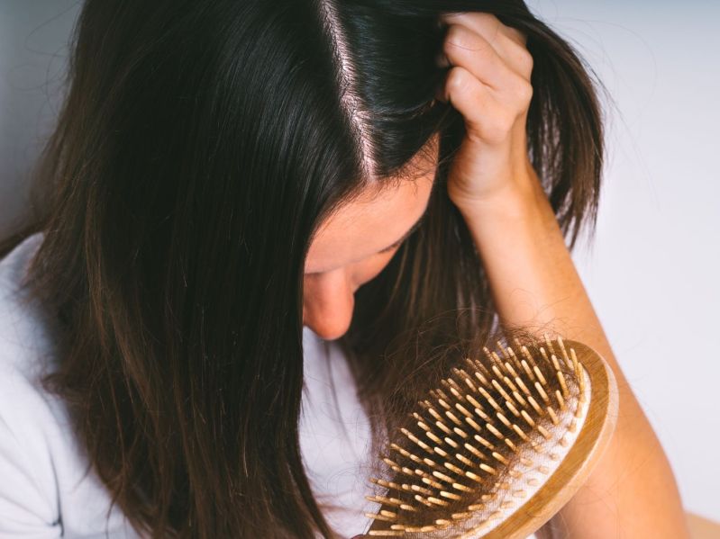 woman with hair loss problem. Hair falling out, hair brush with hair
