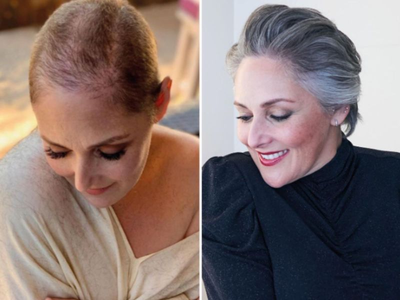 Before and after photos Ricki Lake posted to Instagram showing her hair growth