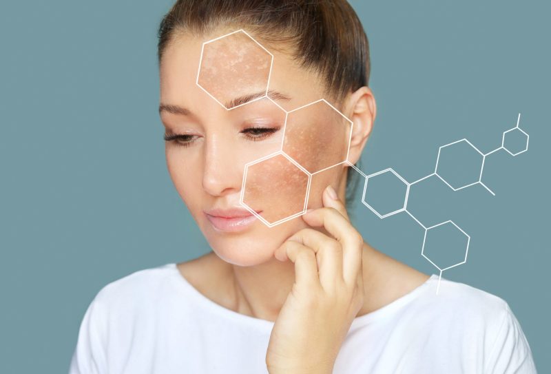 Graphic hexagons over a woman's face highlighting skin damage.