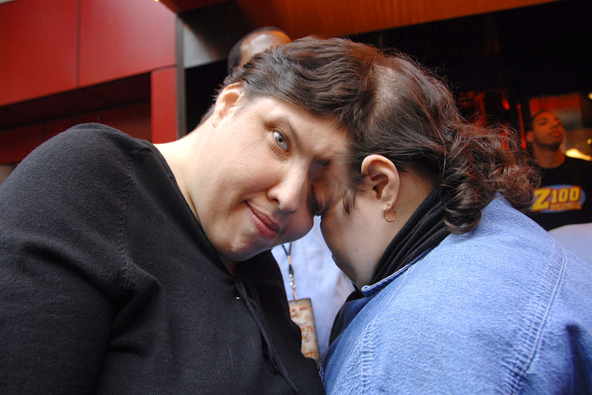 worlds-oldest-conjoined-twins-lori-and-george-schappell-dead-at-62