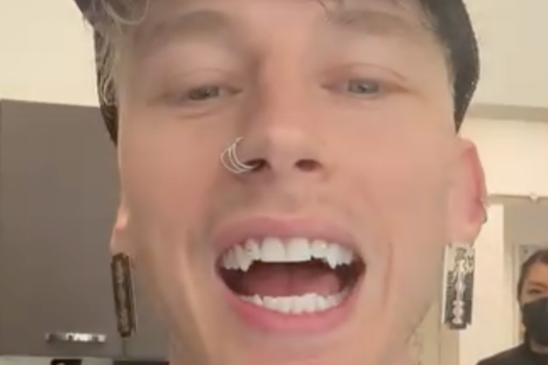 machine-gun-kelly-debuts-fangs-tooth-gems-in-wild-new-look