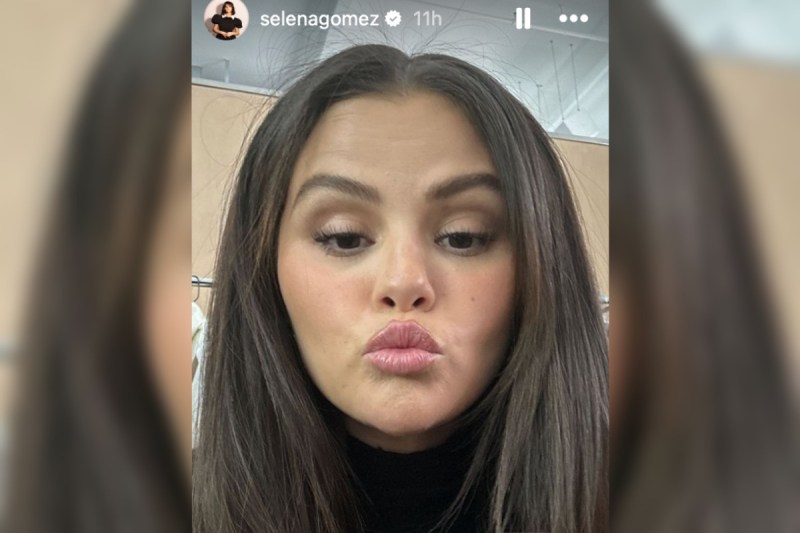 Selena Gomez Reveals the Cosmetic Procedure She’s Had Done