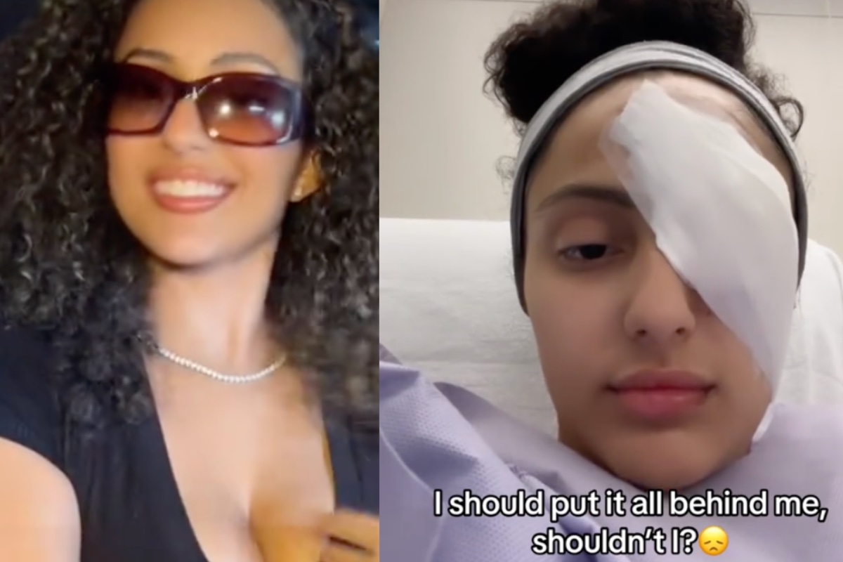 Woman Left Missing Eye After 'Freak Accident' With Dog Leash