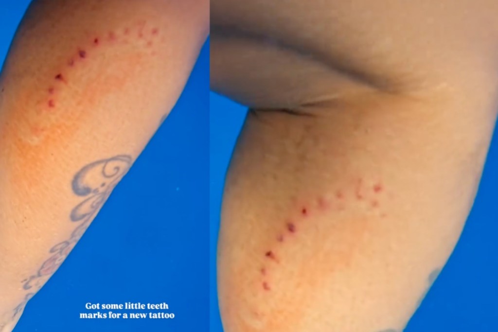 influencer-films-herself-getting-bitten-by-a-shark-watch