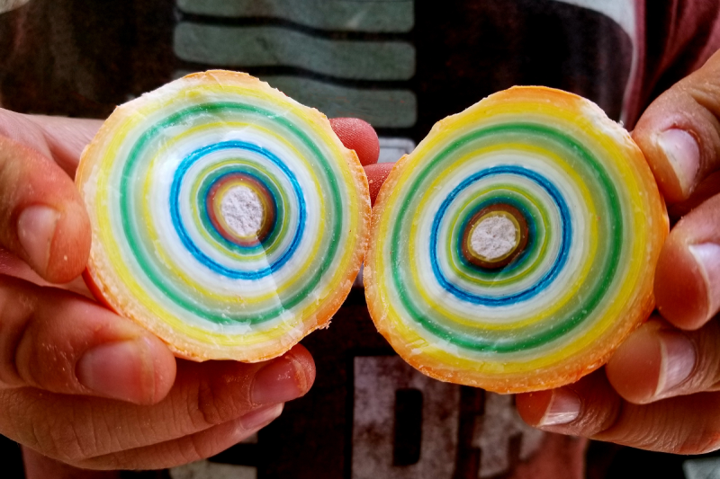 19-year-olds-jaw-wired-shut-after-suffering-fracture-on-jawbreaker-candy-i-havent-eaten-in-42-days