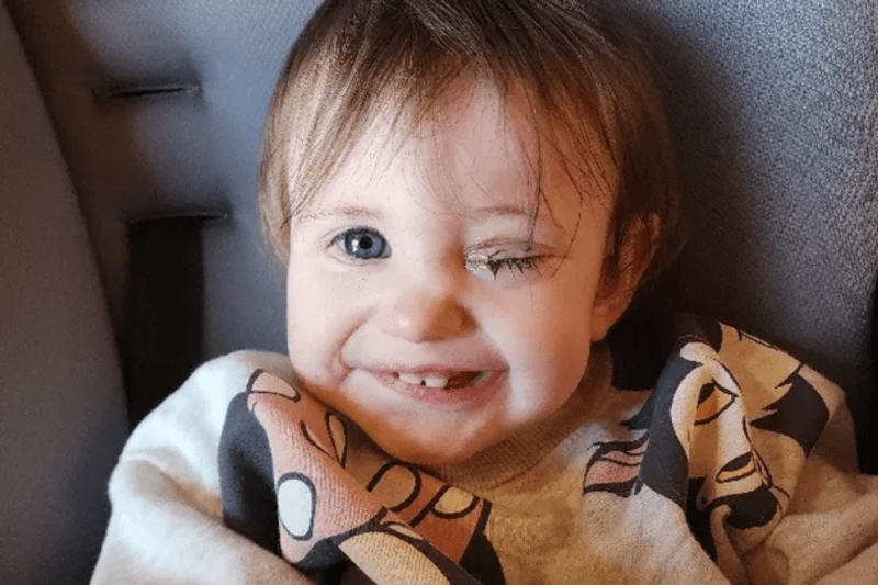 toddler-has-eye-removed-from-rare-retinal-cancer