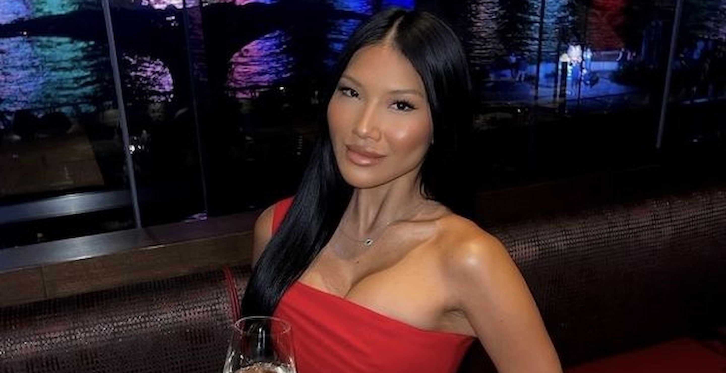 How This 'Love Island' Contestant Nearly Died In A Fire Accident And Battled An “Incurable Tumor”