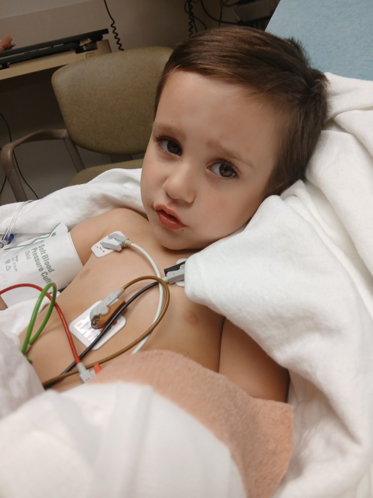 3-Year-Old Boy's Finger Severed In Tricycle Accident