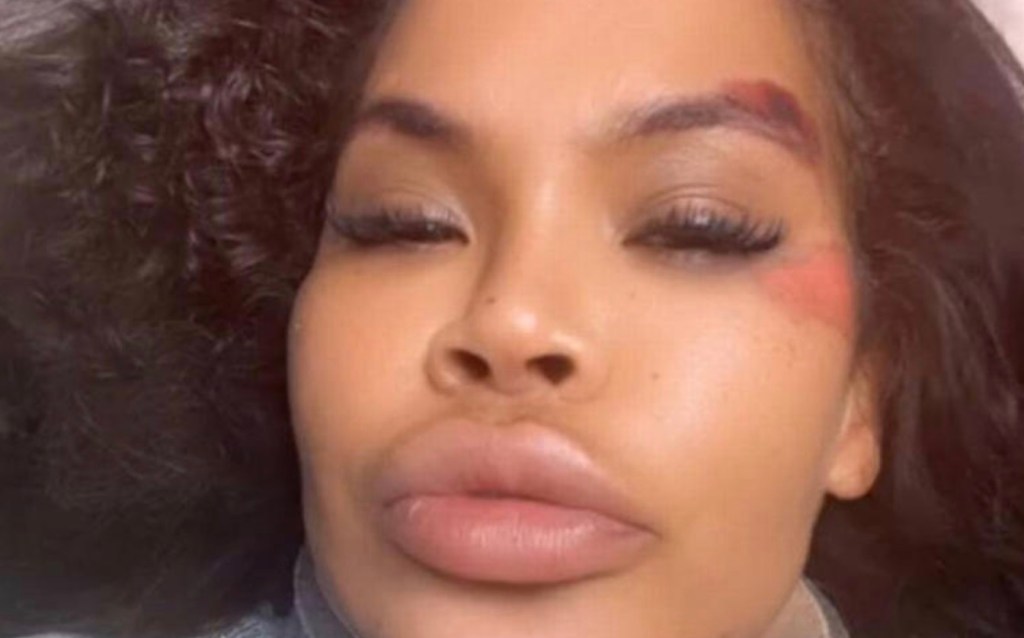 big-brother-star-left-for-dead-after-car-crash-ecu