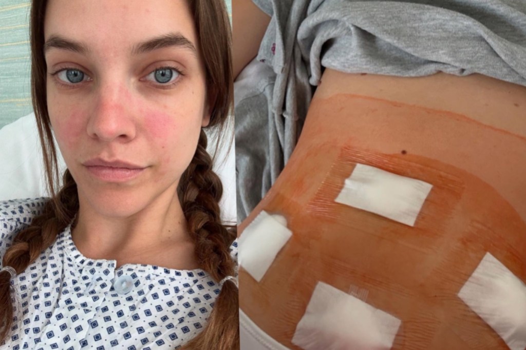 high-profile-sports-illustrated-model-reveals-endometriosis-surgery-ig