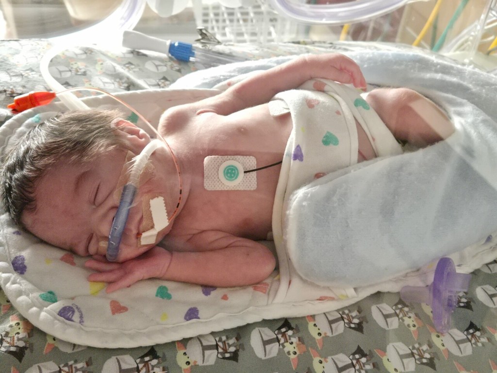Mom Gives Birth After Going Into Cardiac Arrest Chasing After Dog