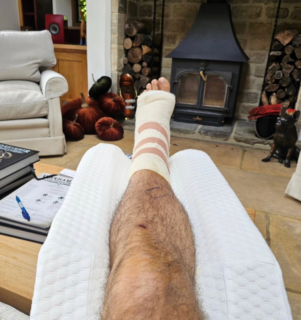 henry-cavill-confirms-reports-about-his-health-with-new-photo-leg