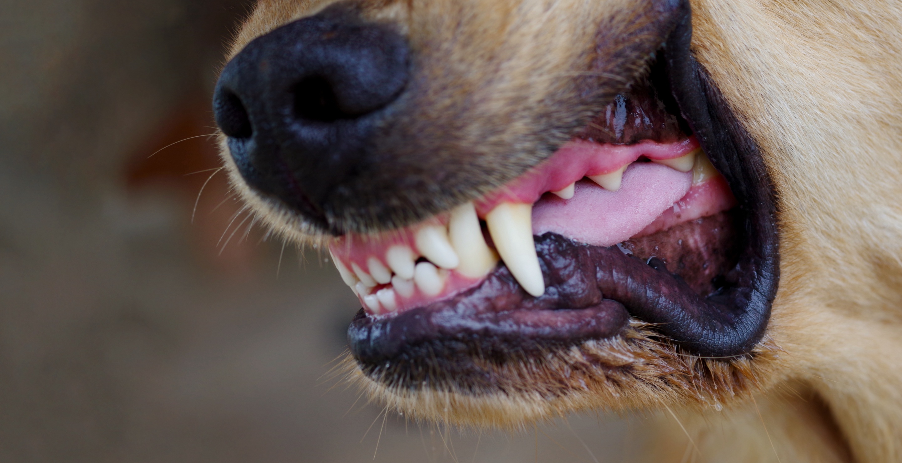 Oklahoma Woman Loses All Her Limbs In Terrifying Dog Attack