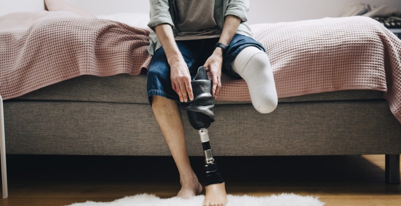 Surgeon Jailed After Amputating Own Legs For $600k