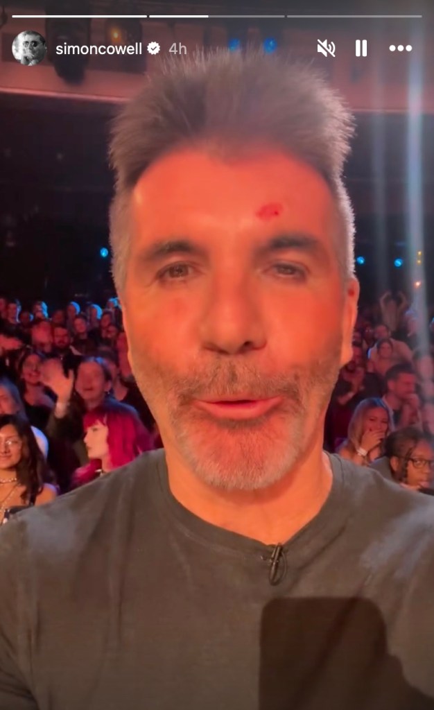 american-idol-legend-suffers-head-injury