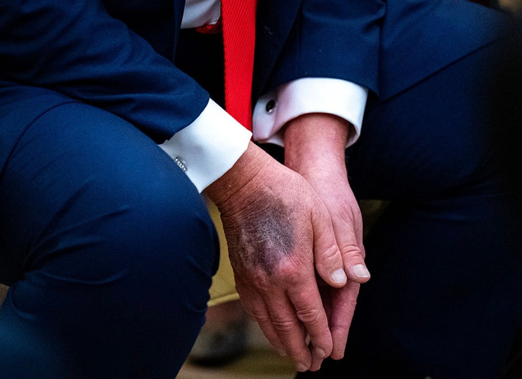 rumps-doctor-declares-president-in-exceptional-health-after-physical