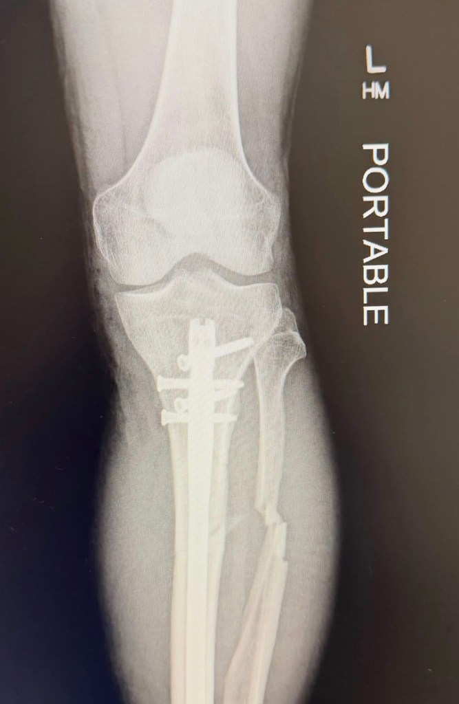 beloved-music-star-seriously-injured-in-stupid-scooter-accident-