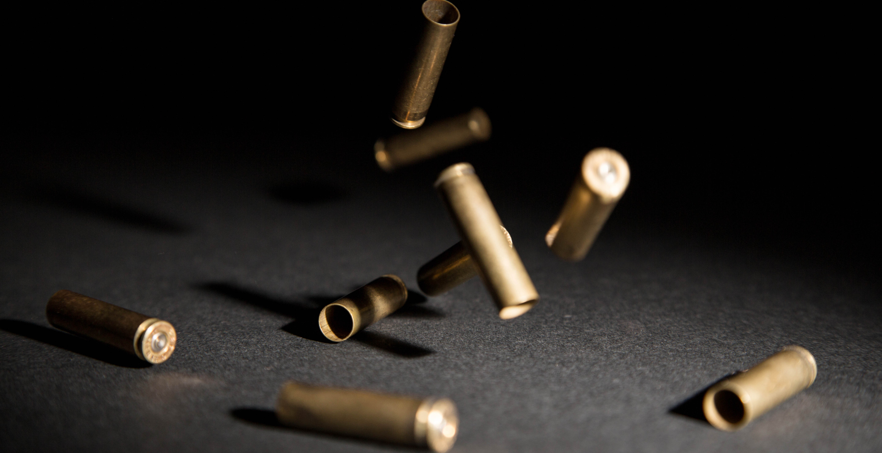 Woman Discovers She's Been Living With Bullet In Her Leg For More Than 20 Years