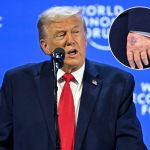 president-trump-responds-to-questions-about-noticeable-bruise-on-left-hand