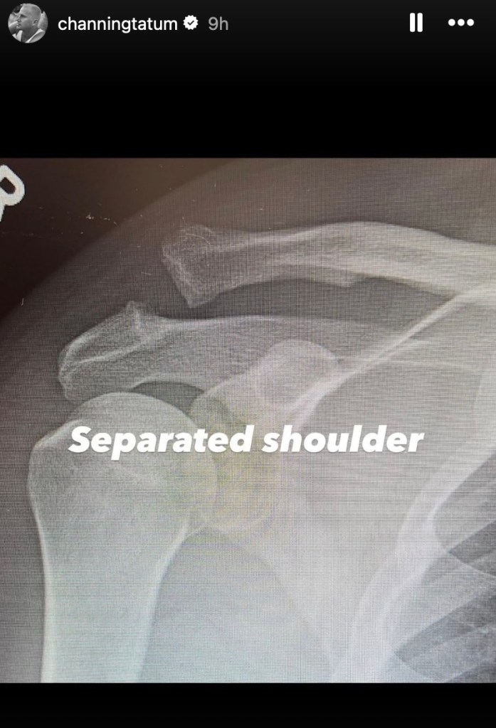 channing-tatum-hospitalized-for-surgery-another-challenge