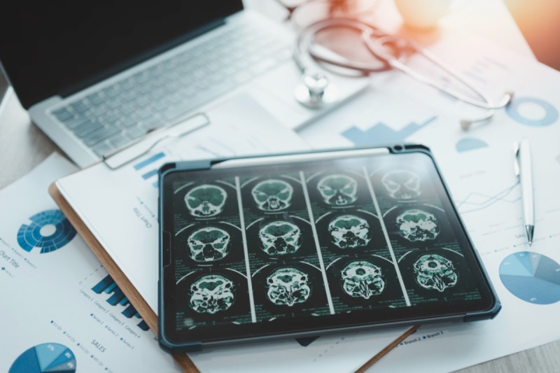 skull-fragments-floating-around-my-brain-90s-pop-singer-reveals-concerning-health-update