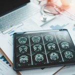 skull-fragments-floating-around-my-brain-90s-pop-singer-reveals-concerning-health-update