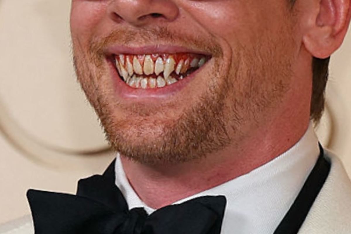 Actor Sports Vampire Fangs on Oscars Red Carpet