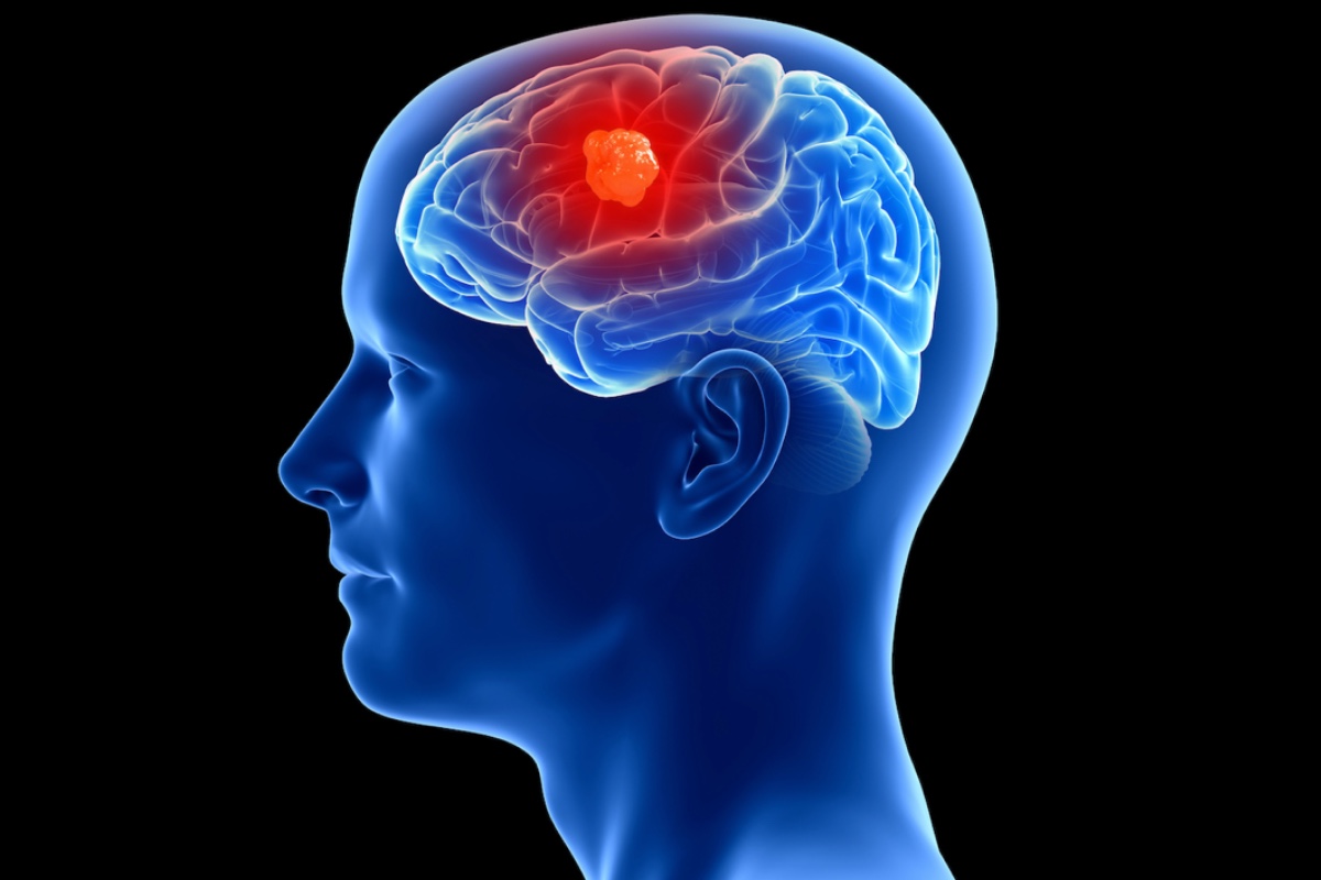 Legendary 95-Year-Old Actor Addresses Brain Cancer Rumors