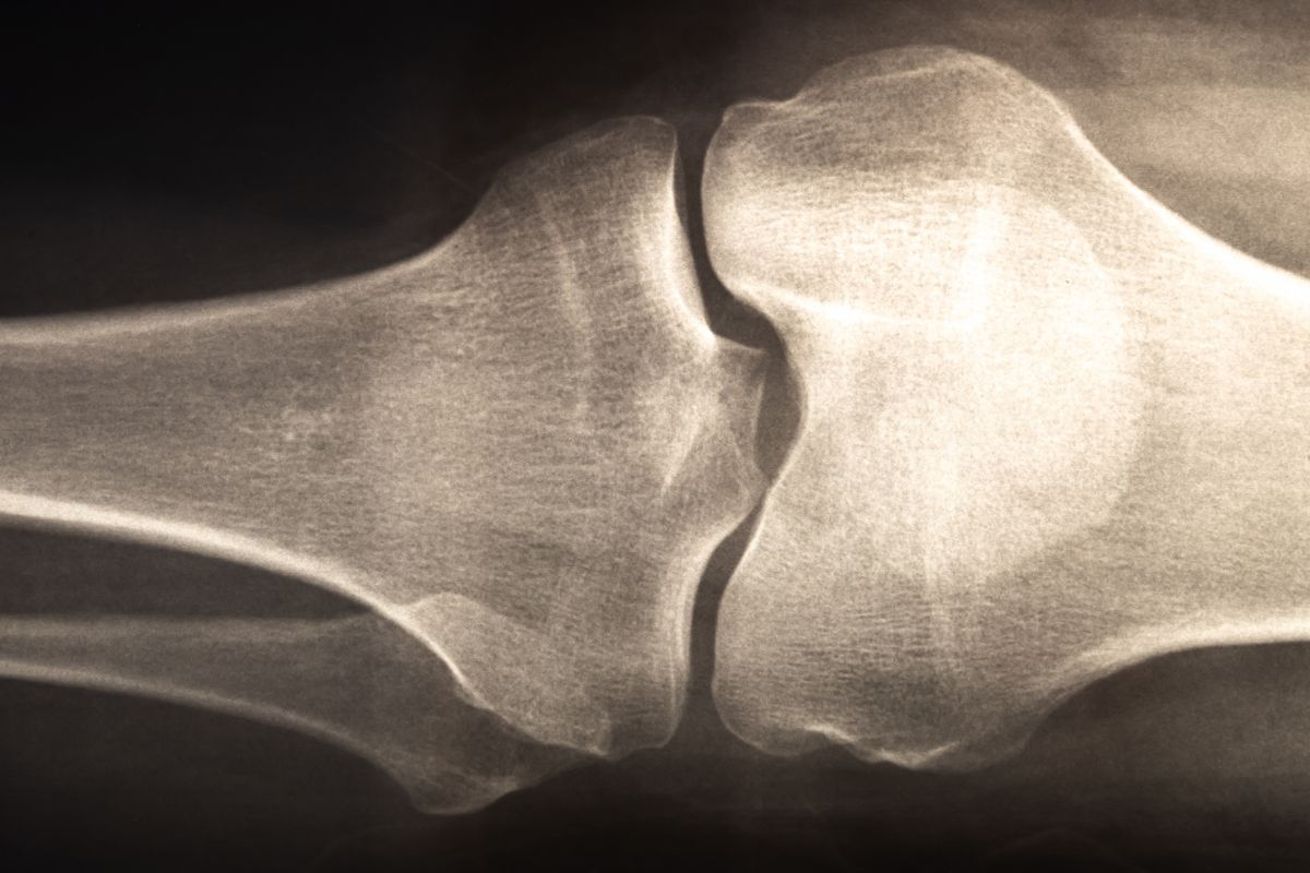 90s-bands-singer-suffers-significant-leg-injury-after-stage-dive