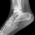 fan-favorite-game-show-personality-breaks-ankle-during-sisters-bachelorette-party-weekend