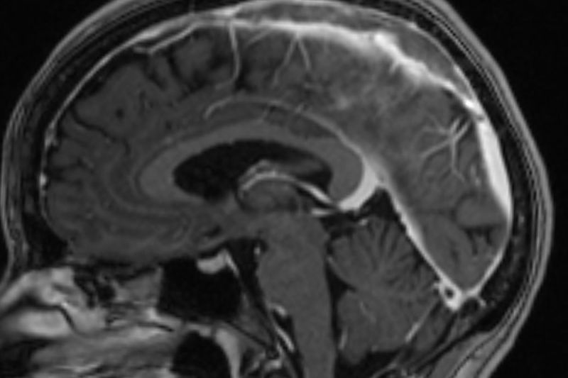90s-rock-legend-diagnosed-with-aggressive-form-of-brain-cancer