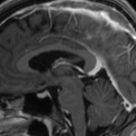90s-rock-legend-diagnosed-with-aggressive-form-of-brain-cancer