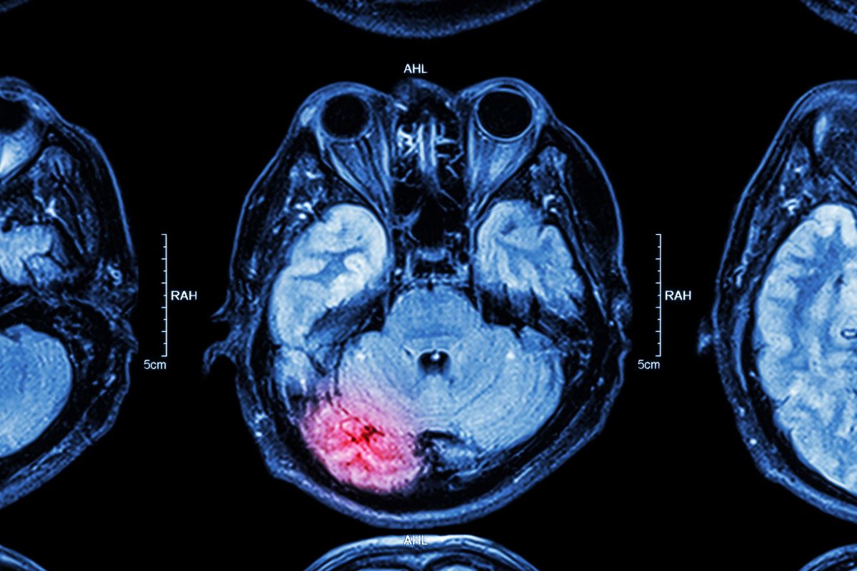 comedian-diagnosed-with-brain-injury-after-multiple-er-visits