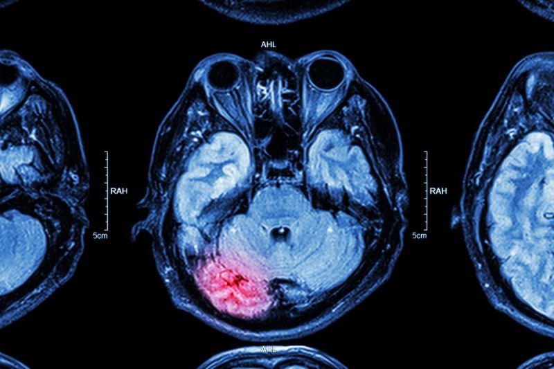 comedian-diagnosed-with-brain-injury-after-multiple-er-visits