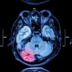comedian-diagnosed-with-brain-injury-after-multiple-er-visits