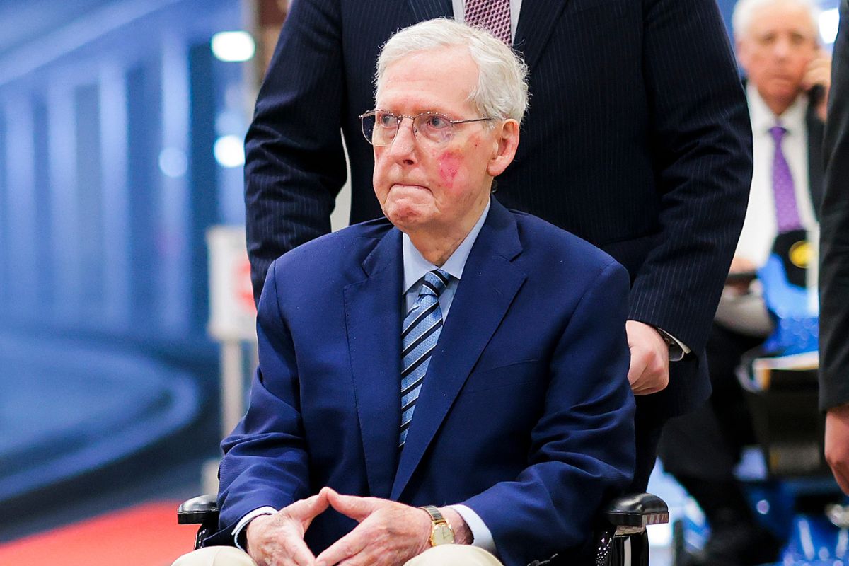 mitch-mcconnell-photo-surface-health