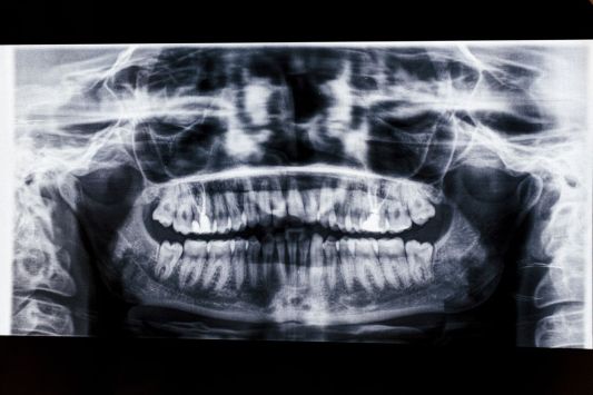 morning-talk-show-host-speaks-out-about-good-bad-habit-that-led-to-mouth-surgery