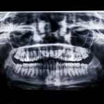 morning-talk-show-host-speaks-out-about-good-bad-habit-that-led-to-mouth-surgery