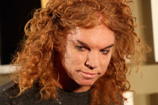 carrot-top-hospitalized-after-reported-suicide-attempt